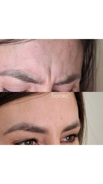 Косметолог, епіляція, корекція фігури