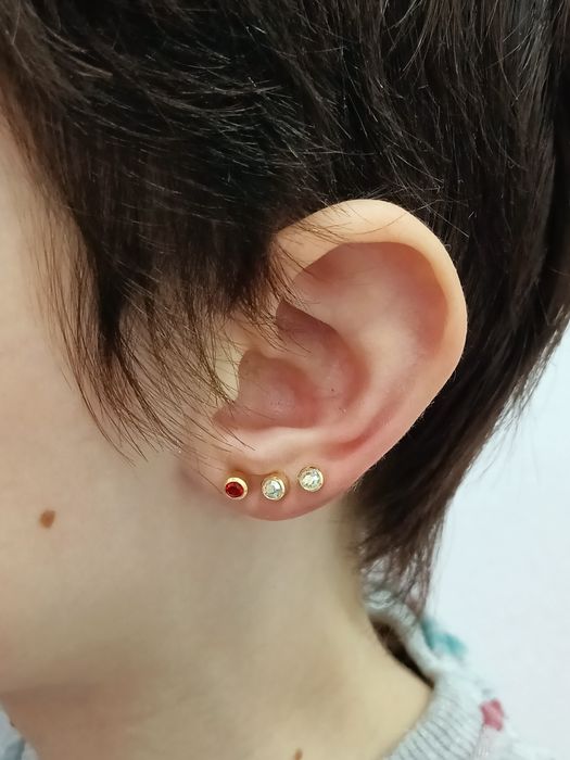 Косметолог, Біоревіталізація, Ботокс, Контурна пластика , мезотерапія.