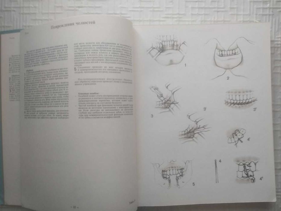 Экстренные специальные оперативные вмешательства. Богуслав Нидерле