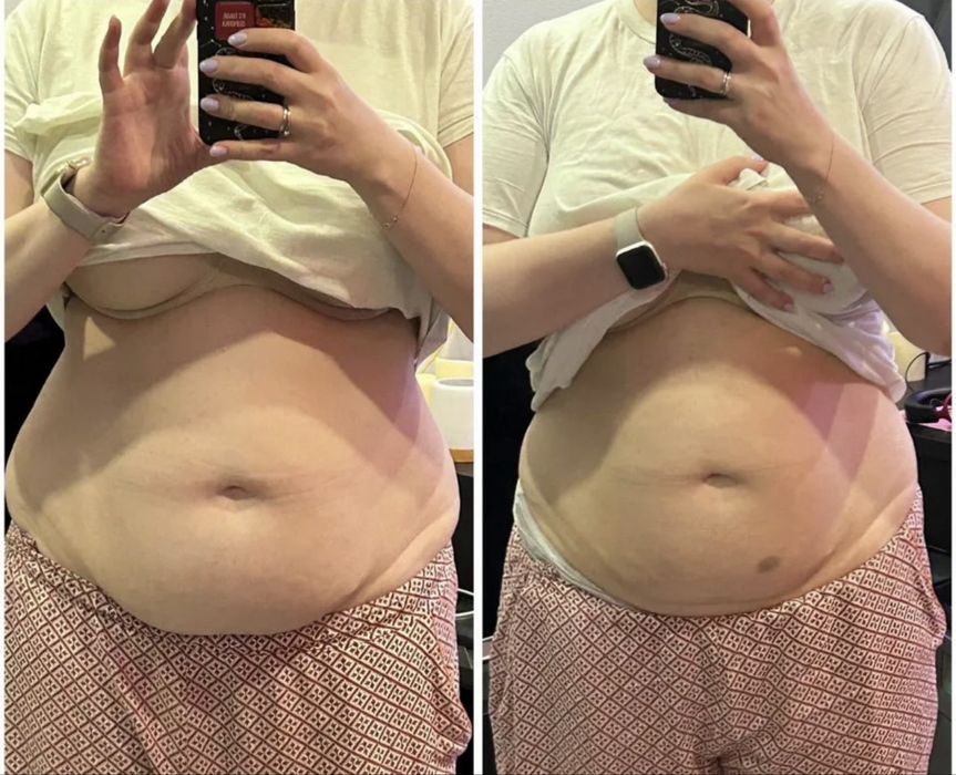 Схуднення швидко без страждань