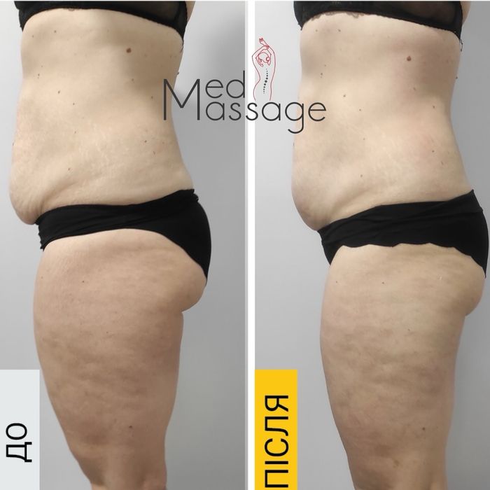 Лікувальний масаж ,масаж обличчя, спа ,салон