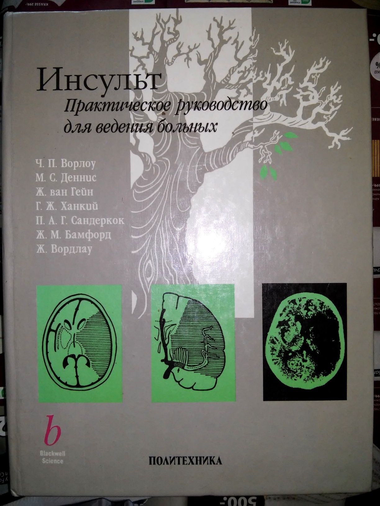 Ворлоу Инсульт Практическое руководство для ведения больных 1998