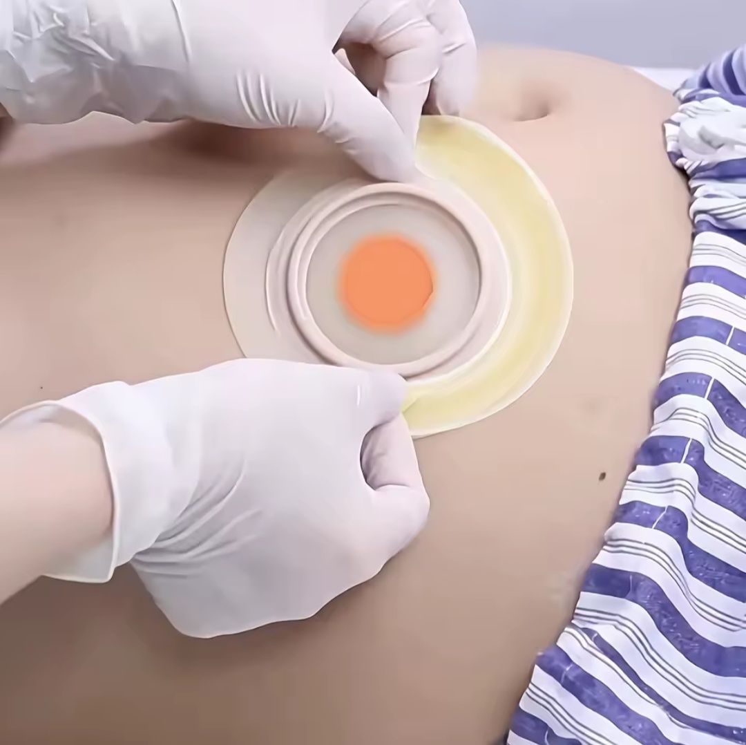 Półpierścienie półksiężyce uszczelniające Coloplast zamiennik