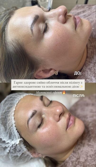 Косметолог Одеса!Знижка на перше відвідування!