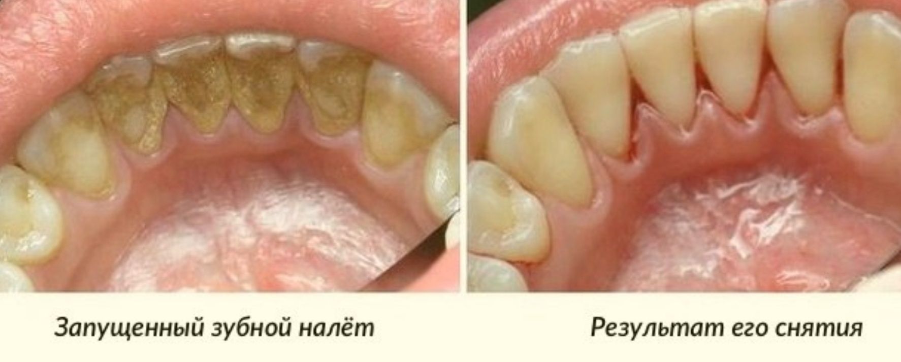 Стоматолог. Лечение и протезирование зубов