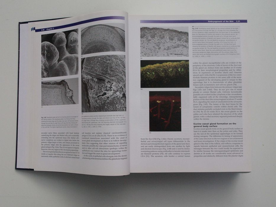 Harper's Textbook of Pediatric Dermatology, 3rd Edition  Vol. 1 & 2