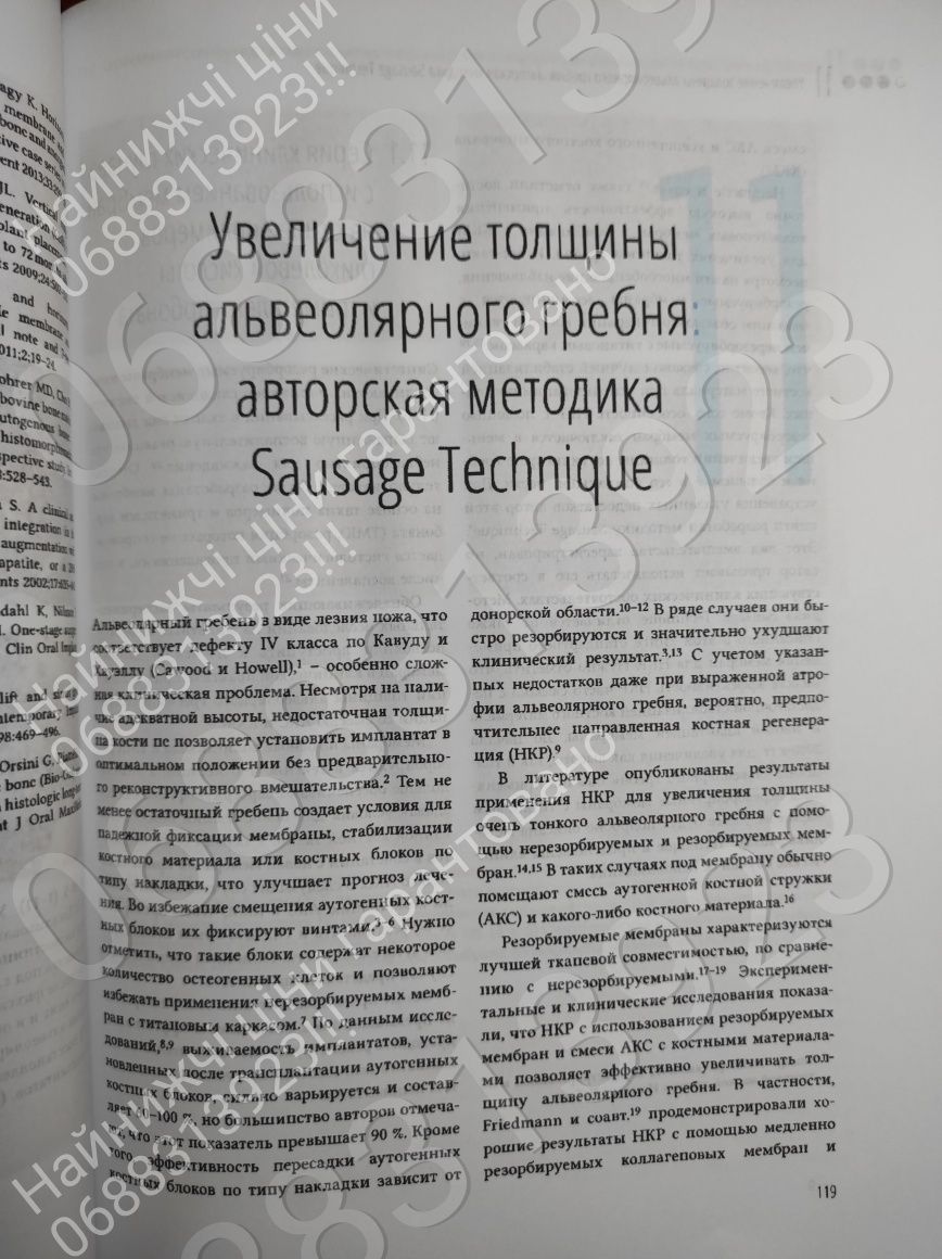 ДЕШЕВО!!! Увеличение висоти и толщини альвеолярного гребня,Иштван Урб.