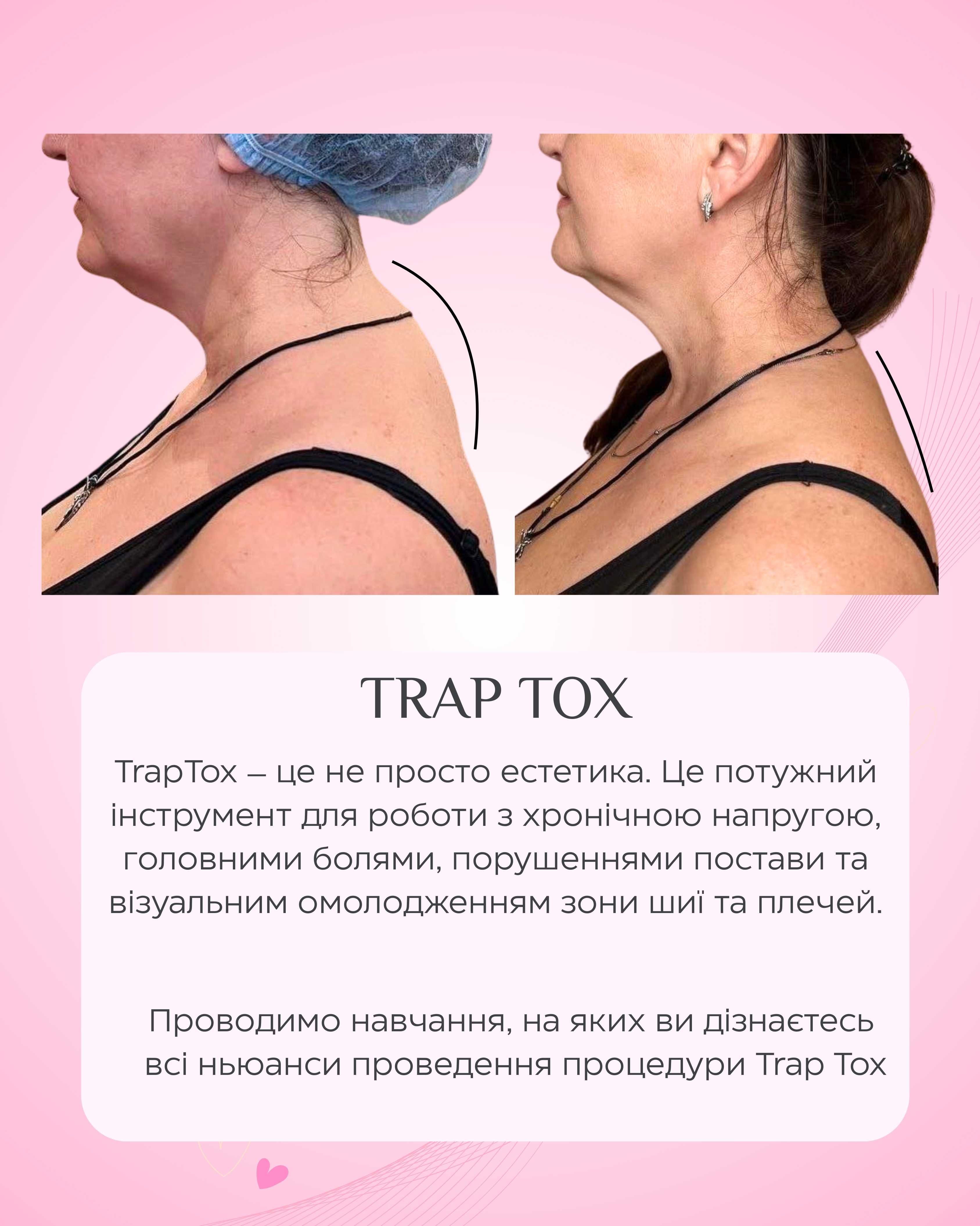 Акцiя !Косметологiчнi процедури