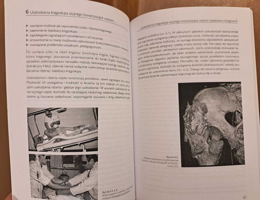 Nowa: "Urazy czaszkowo-mózgowe. Diagnostyka, leczenie, rehabilitacja"