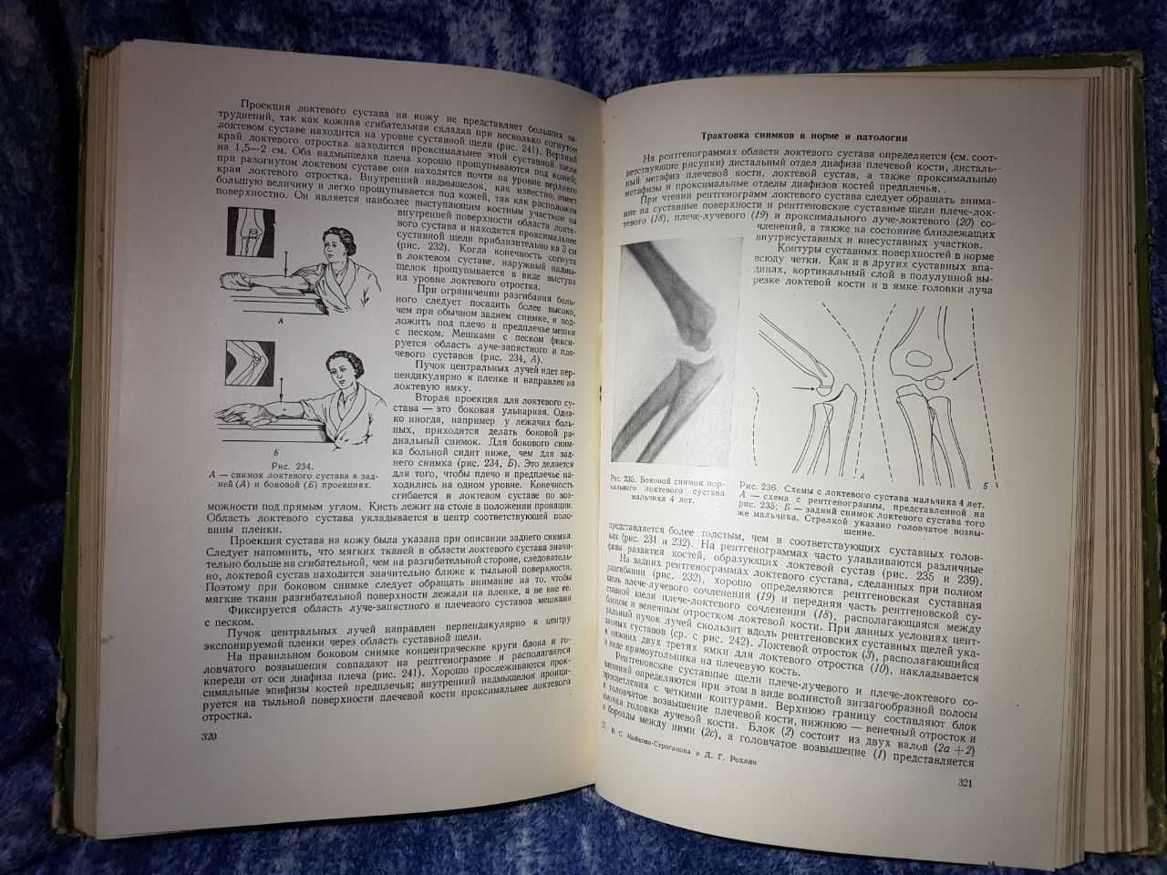 Книга Д. Г. Рохлин кости и суставы в рентгеновском изображении 1957 г