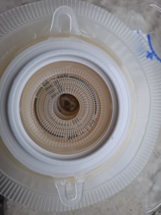 Калоприймачі 2х компонентні