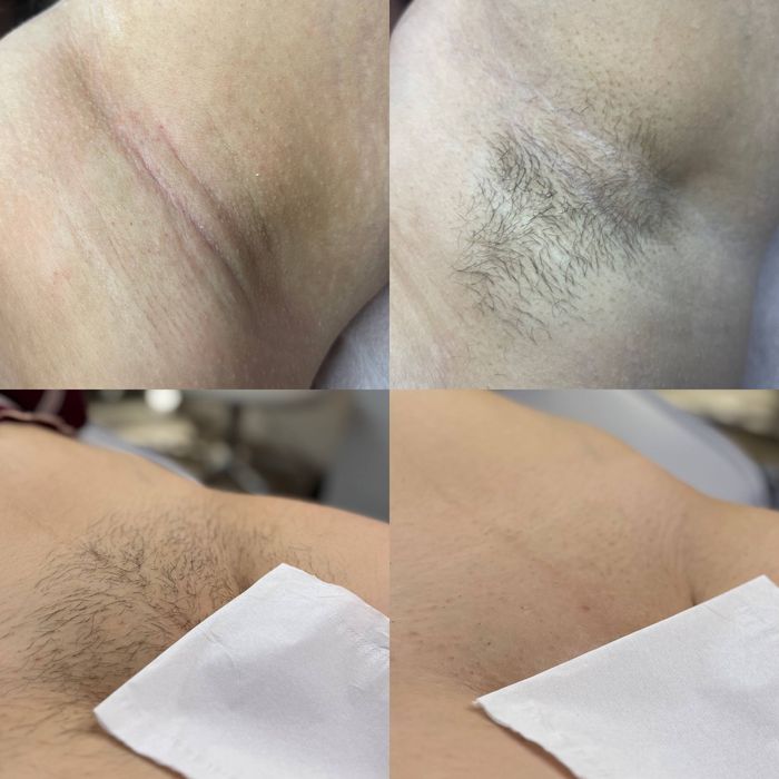 Шугаринг ,Депіляція Дніпро Перемога