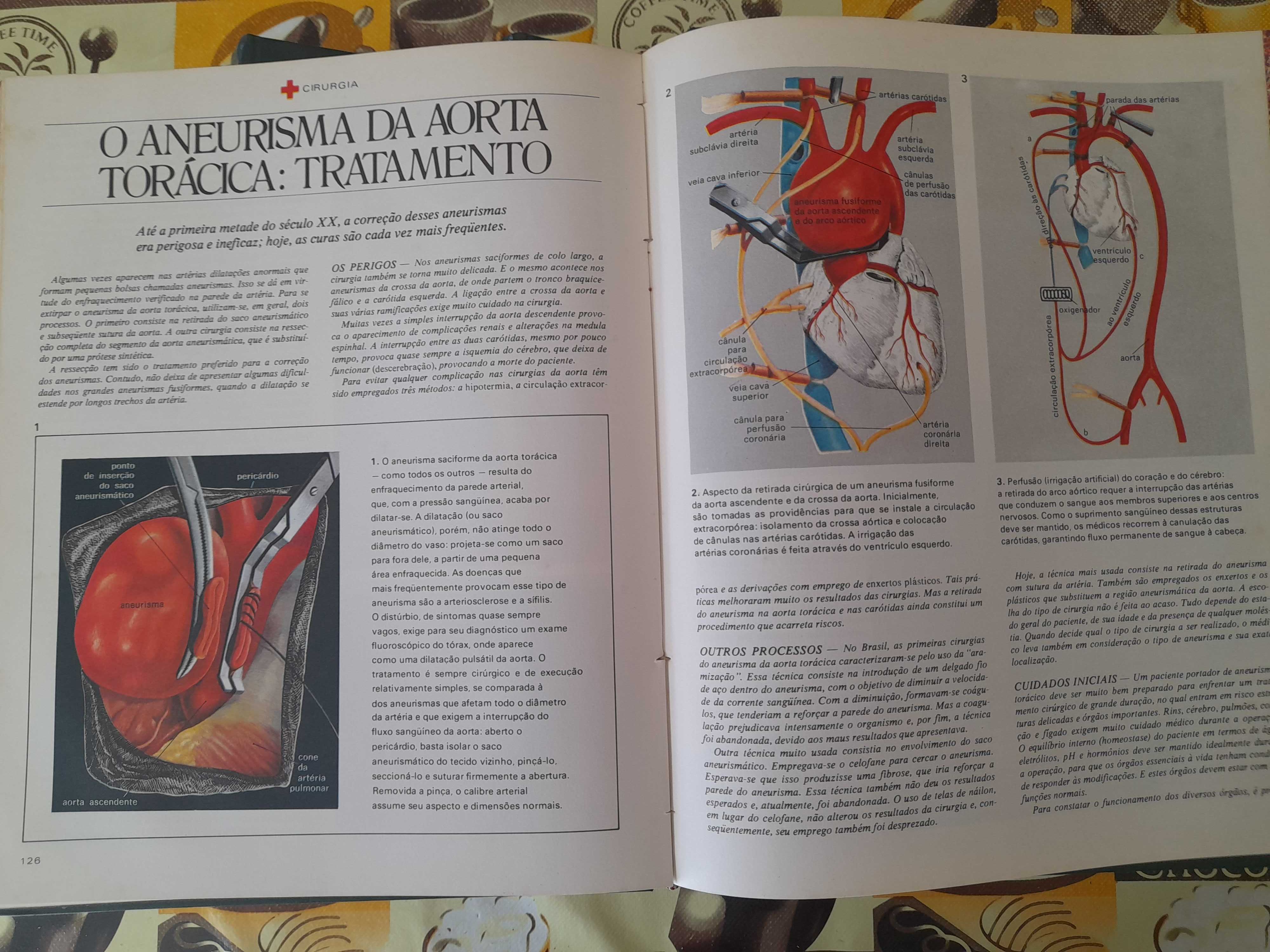 Enciclopédia Ilustrada Medicina e Saúde (6 volumes)