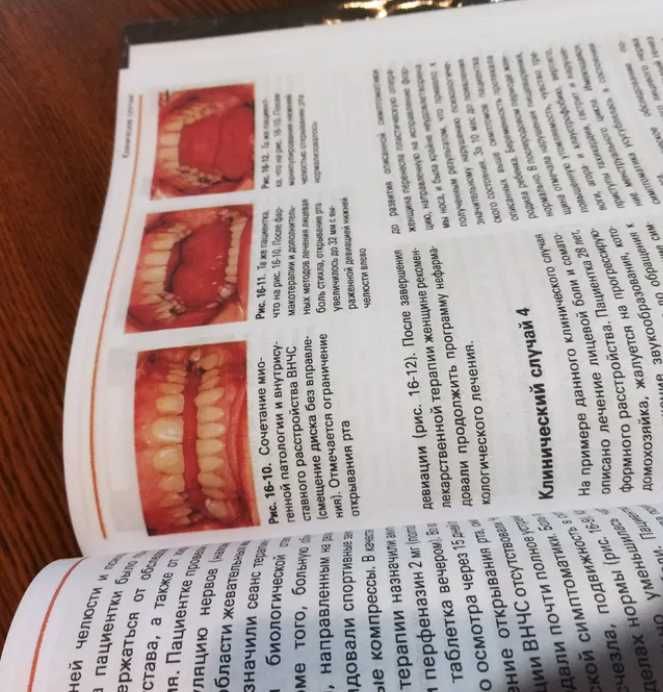 NEW‼️ Височно-нижнечелюстные расстройства Стоматологічні книги гнатоло