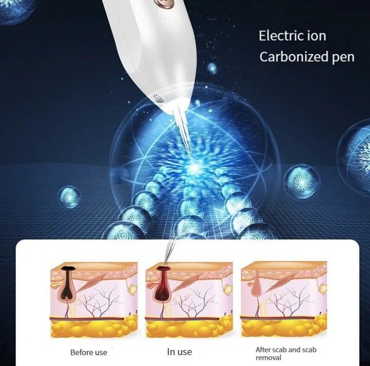 Электрокоагулятор для удаления папиллом и бородавок аппарат косметолог