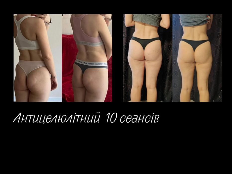 Масаж Київ. Оболонь. Мінська