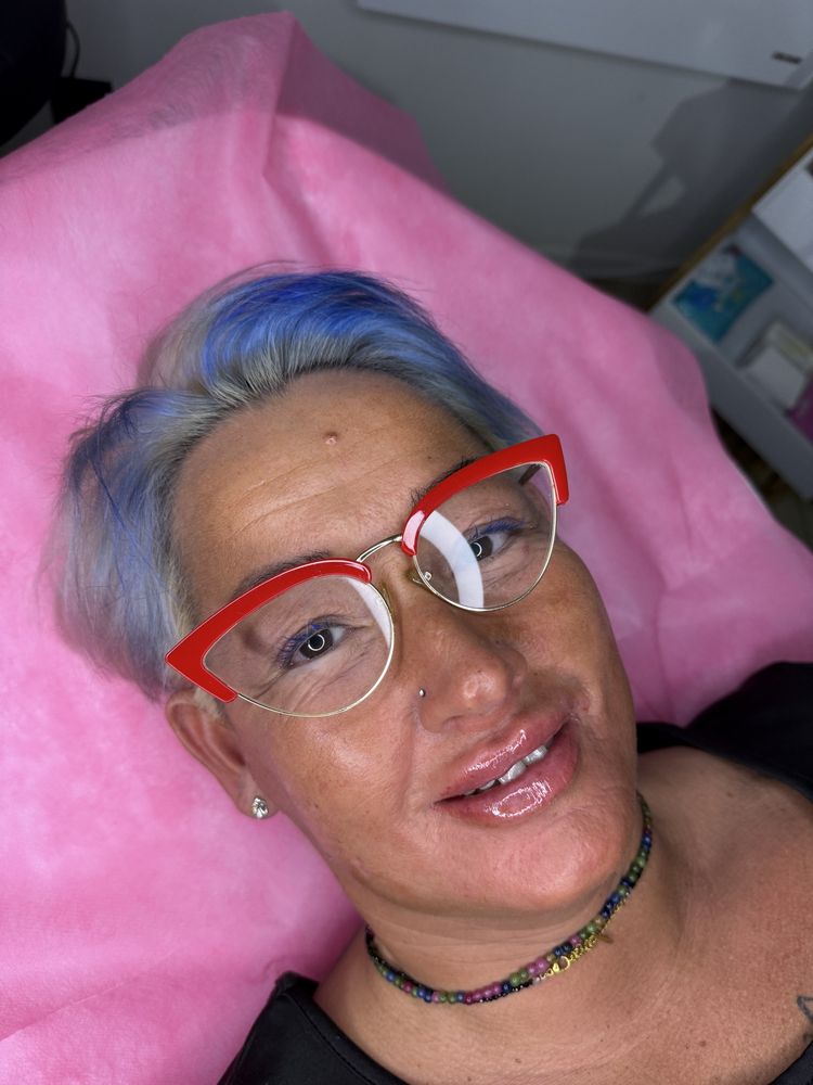 Powiększanie Ust 450 zł Russian Lips  BOTOX 500 zł