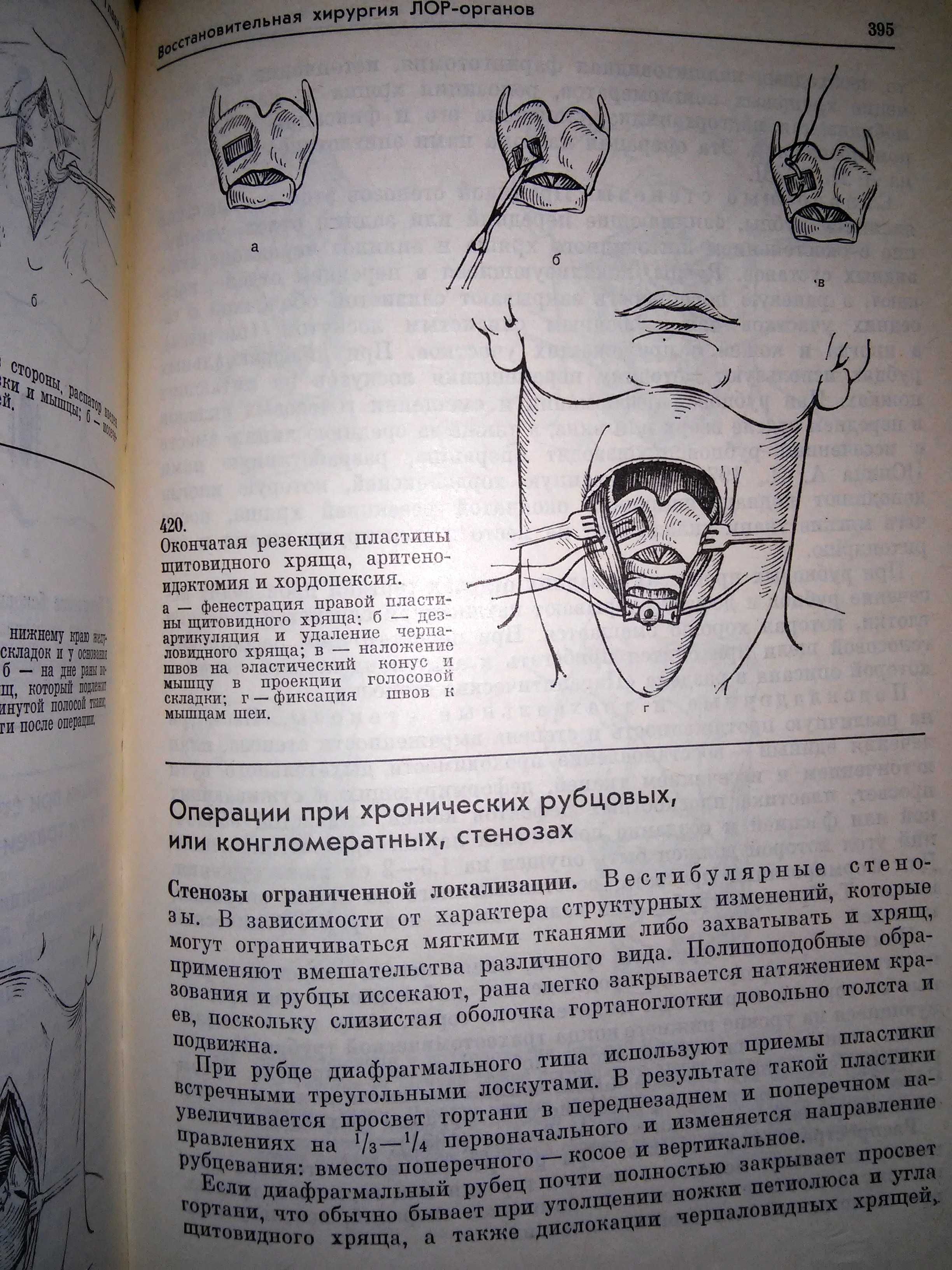 Погосов Атлас оперативной оториноларингологии