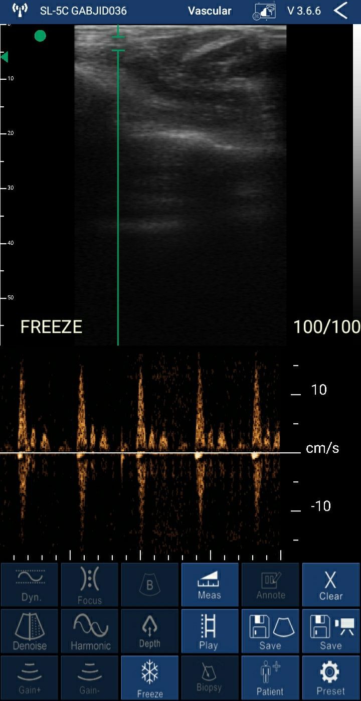 Ecógrafo: Sonda c/Doppler WiFi 5G (192 elementos ) + App