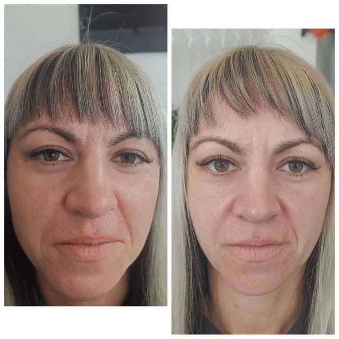 Опытный косметолог | Чистки, пилинги, инъекции