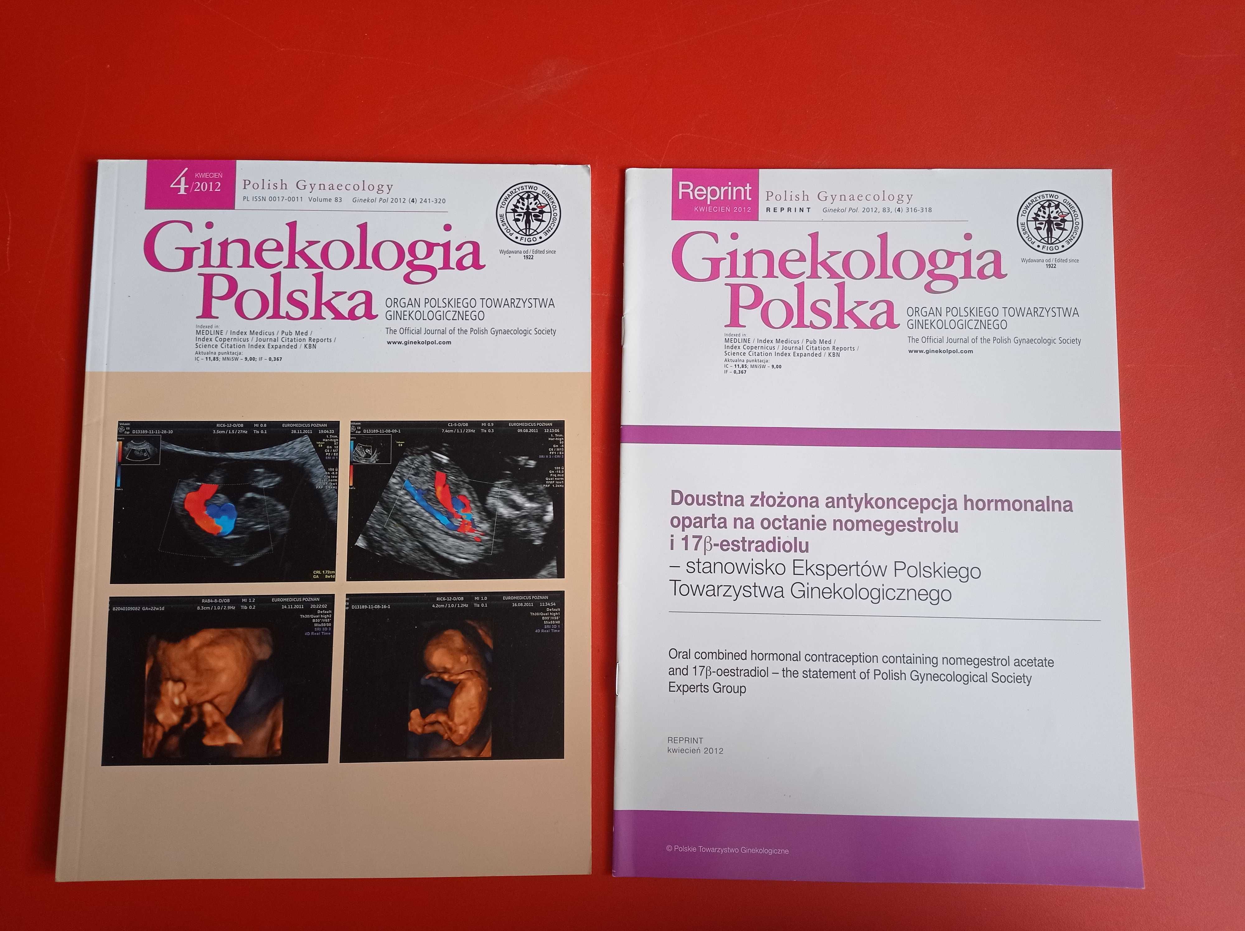Ginekologia Polska, nr 4/2012, kwiecień 2012