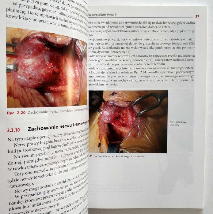 Kolorowy atlas chirurgii tarczycy. Zabiegi "na otwarto", endoskopowe