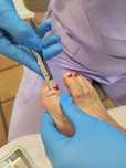 Pedicure medical domiciliar