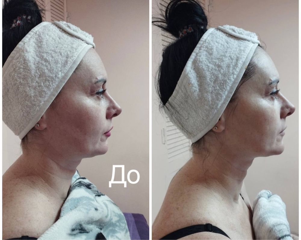 Корекція фігури. До -10 см за тиждень.