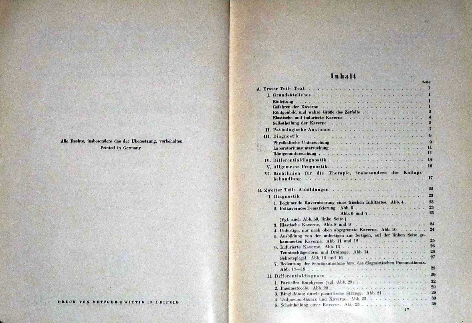 Jaskinia gruźlicza, jej rozwój, wykrywanie, zapobieganie i leczenie