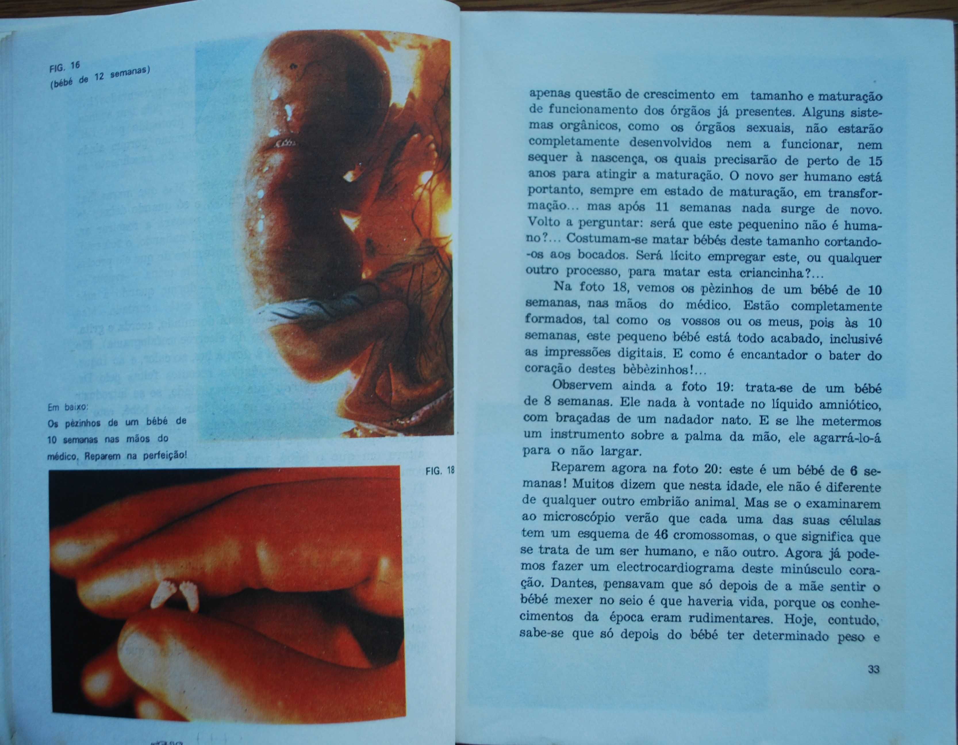 Aborto A Escravatura da Mulher A Verdade em 23 Fotos