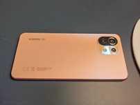 Xiaomi 11 Lite 5G NE