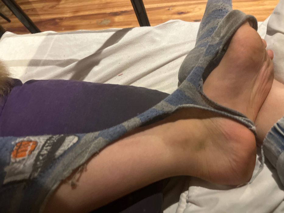 Skarpeta dziurawa z pepco