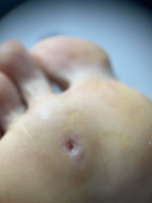 Подолог Мукачево,педикюр Мукачево