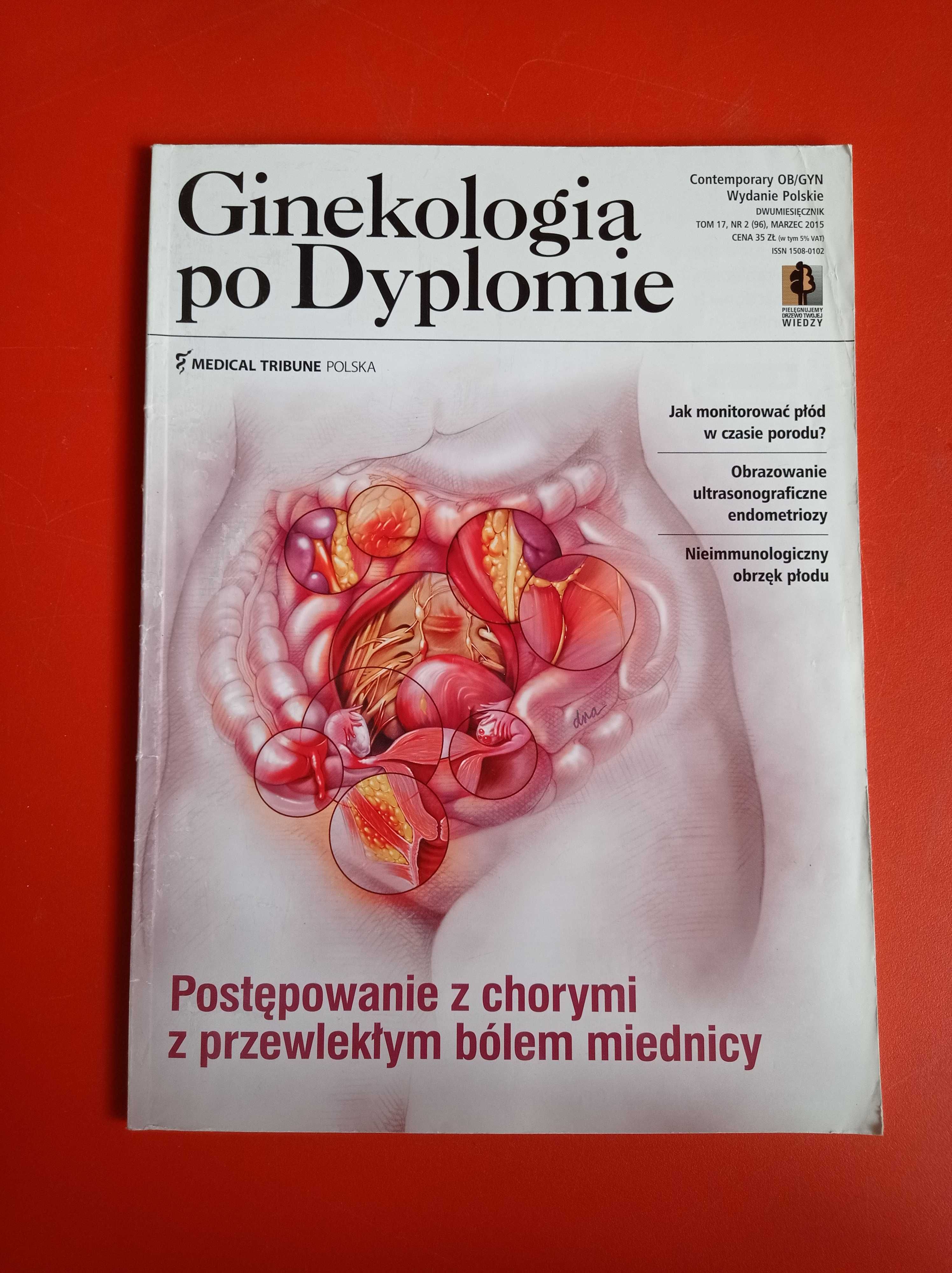 Ginekologia po dyplomie, nr 2, tom 17, marzec 2015