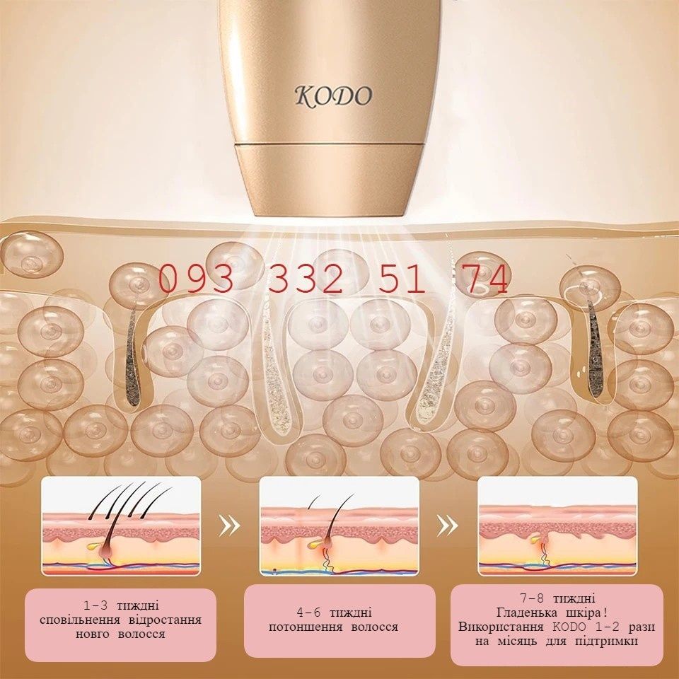 Лазерний IPL епілятор KODO 2024