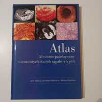 Atlas patologiczny nieswoistych chorób zapalnych jelit
Wejman Bartnik