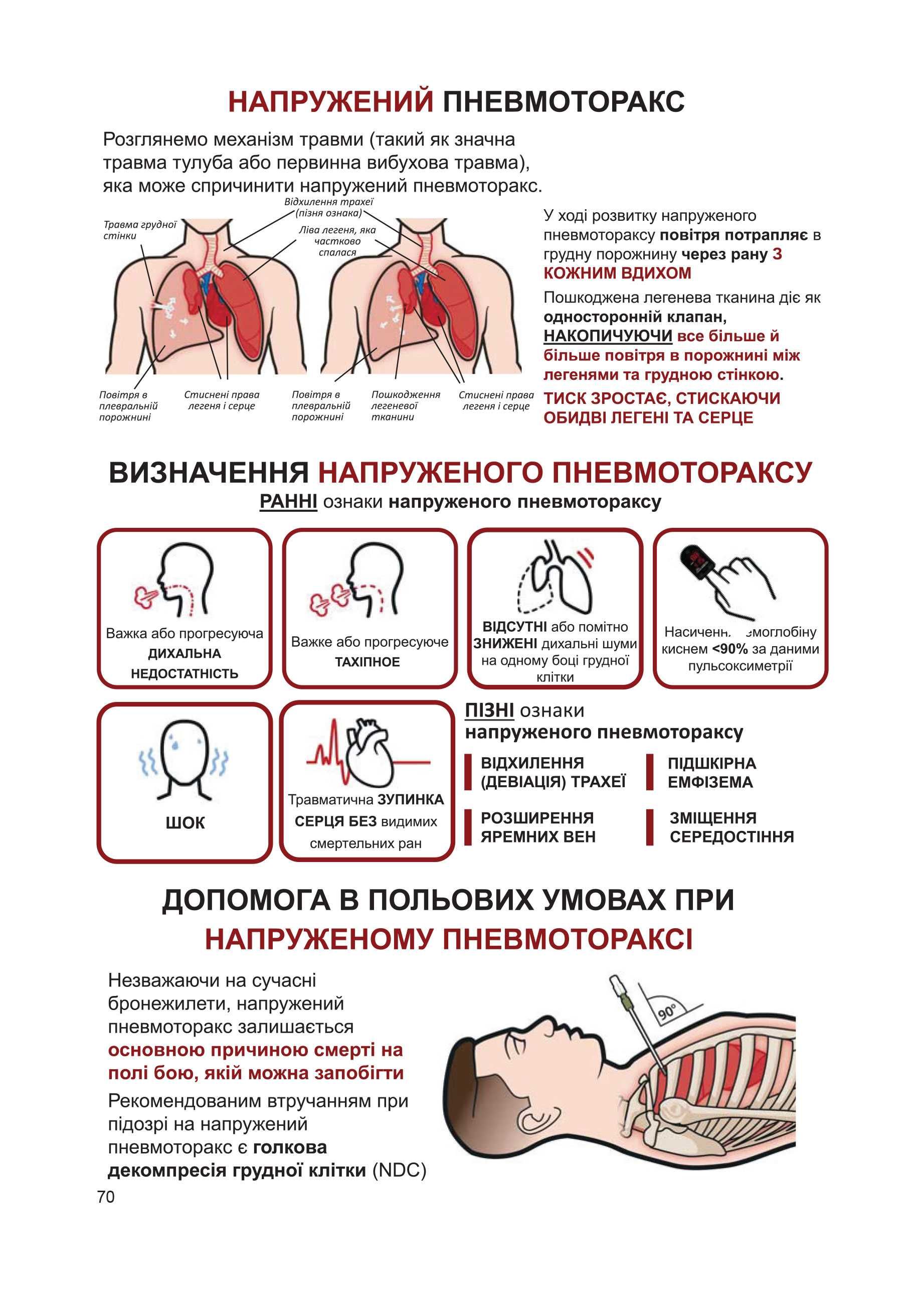 MARCH. Тактична медицина. "Курс бойового медика". TCCC-CMC