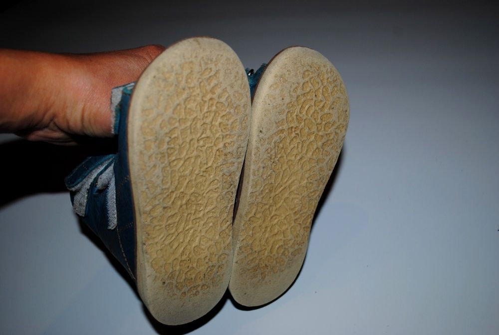 Ортопедические босоножки ortofoot 14,5 см вальгус антиварус кожаные