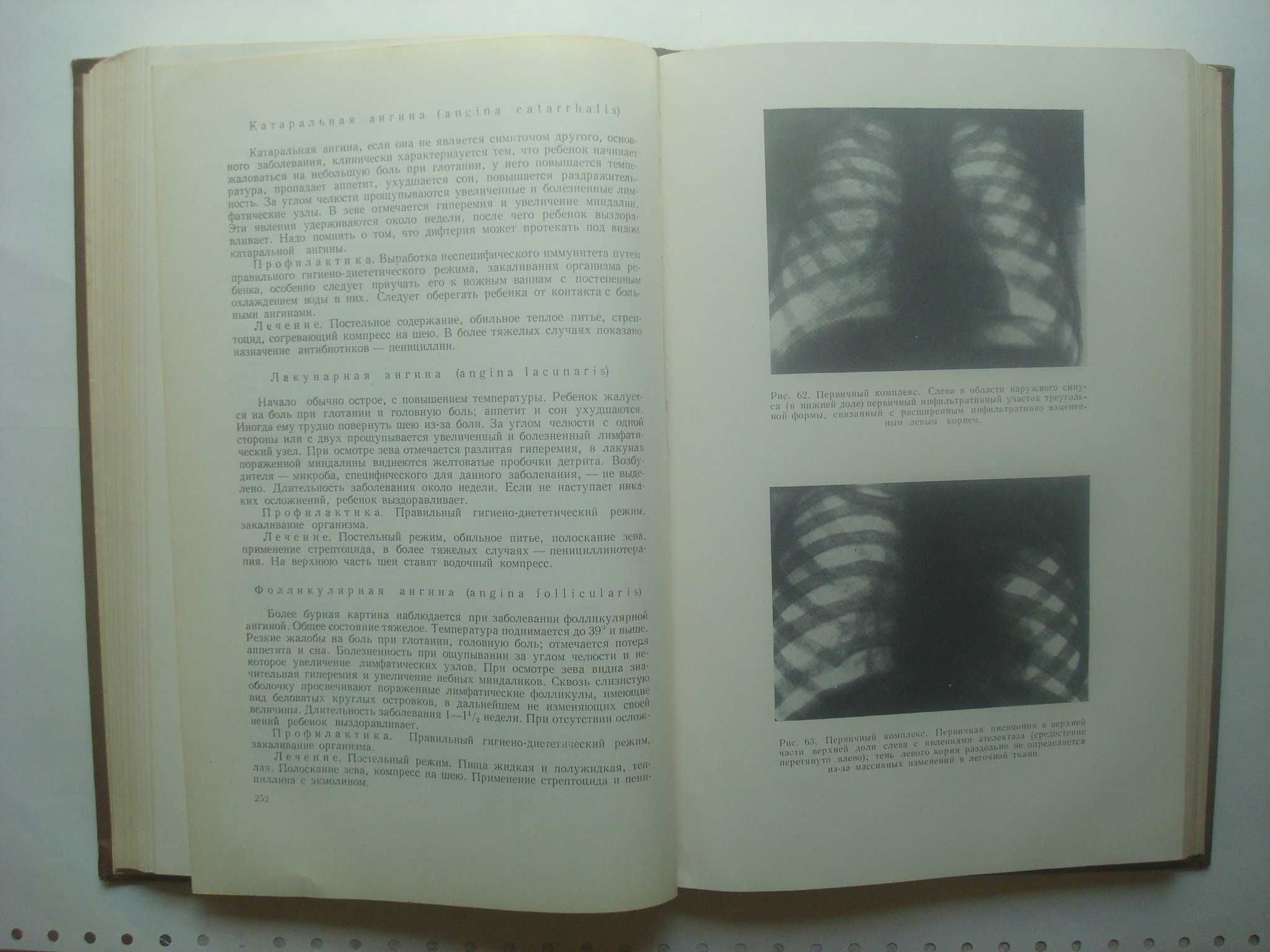 Учебник детских болезней. В.А.Власов, Н.И.Осиновский...