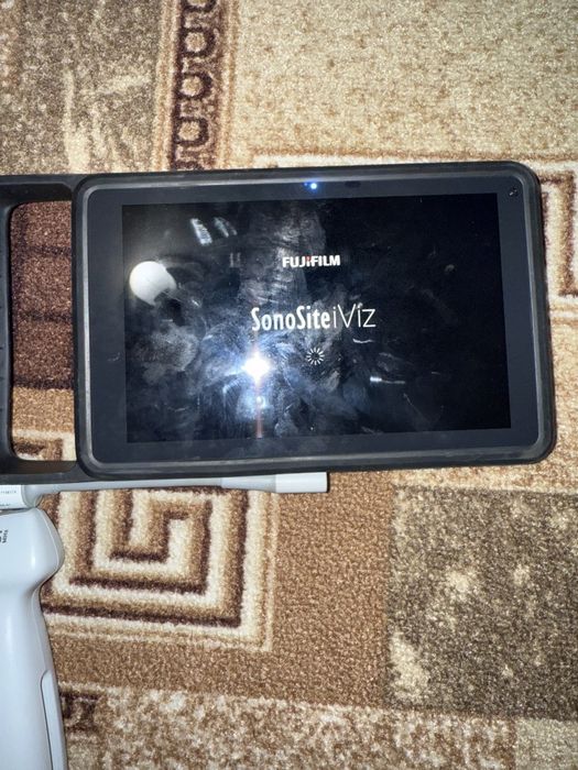 УЗД   SONOSITE iViz Portable  Ultrasound.