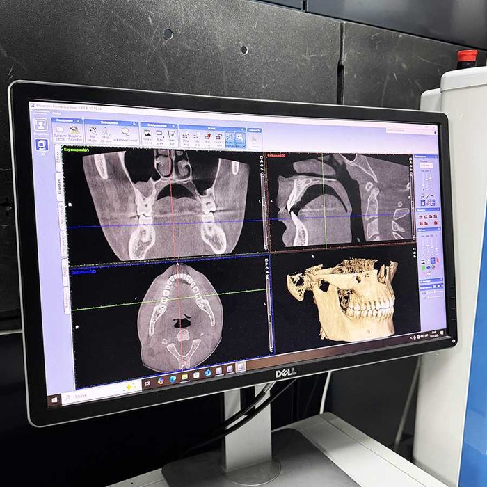 Комп'ютерний Томограф Planmeca ProMax® 3D Mid