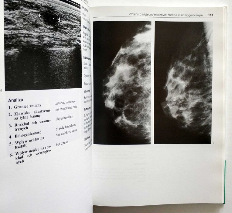 Atlas ultrasonograficzny sutka, Leucht, Madjar, UNIKAT!