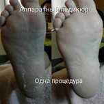 Аппаратный педикюр - центр - 400 - 500 грн.