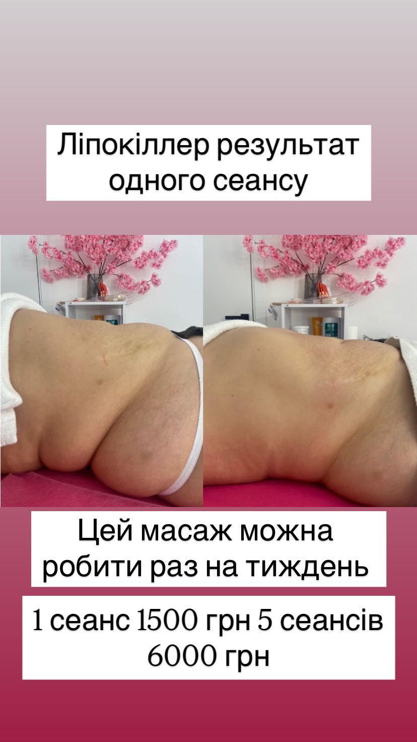 Масаж на Каманіна