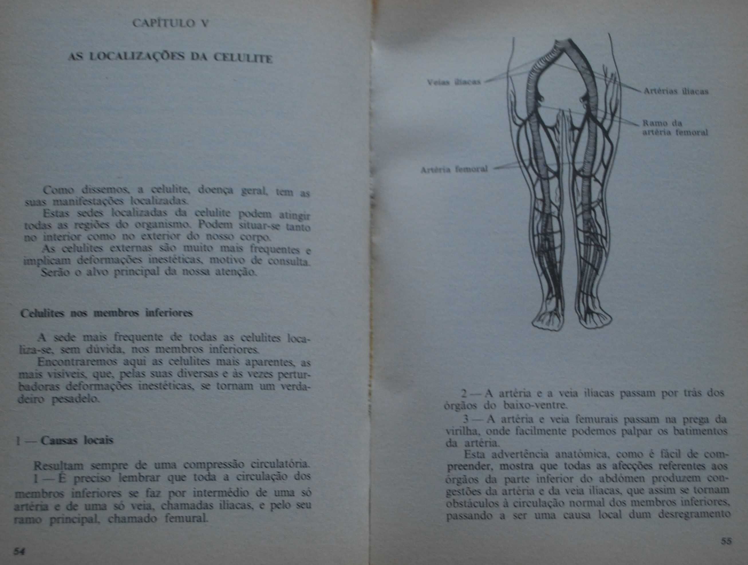 A Celulite (Causas e Tratamentos) de Gérard J. Léonard