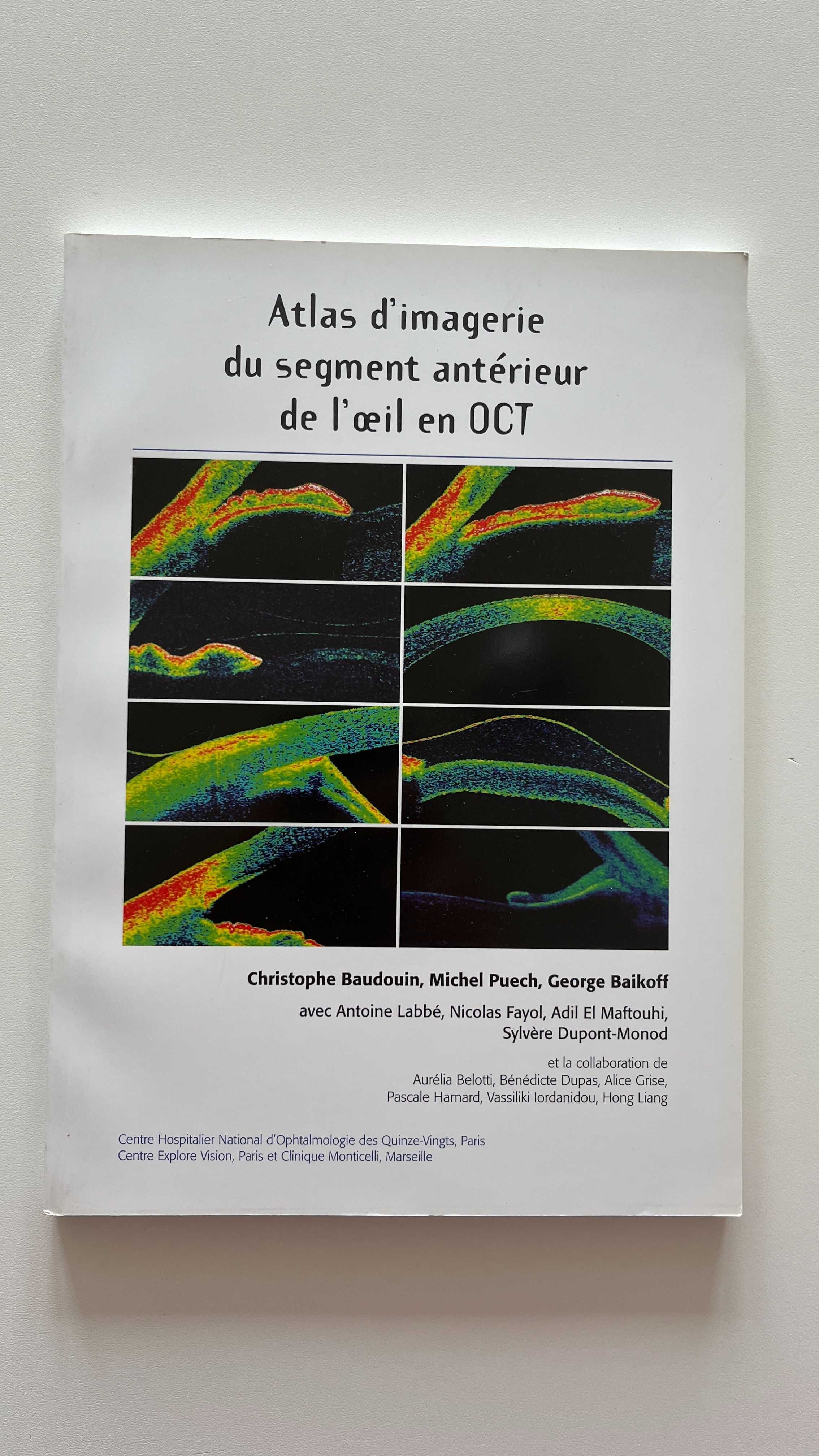 Atlas d'imagerie du segment anteriueur de loeil en OCT