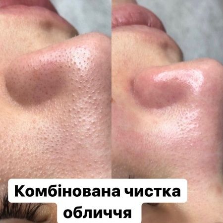 Косметолог Хаджибейський р-н 700грн