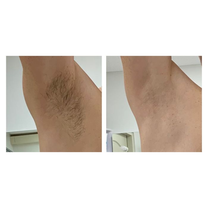 Воскова депіляція. Шугаринг. Павлоград (центр)