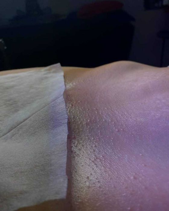 Депіляція, метро Дарниця,Воскресінка,Троєщина,Лівий берег