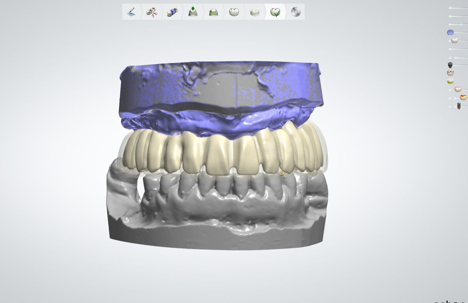 Protezy zębowe modelowanie 3shape technik dentystyczny